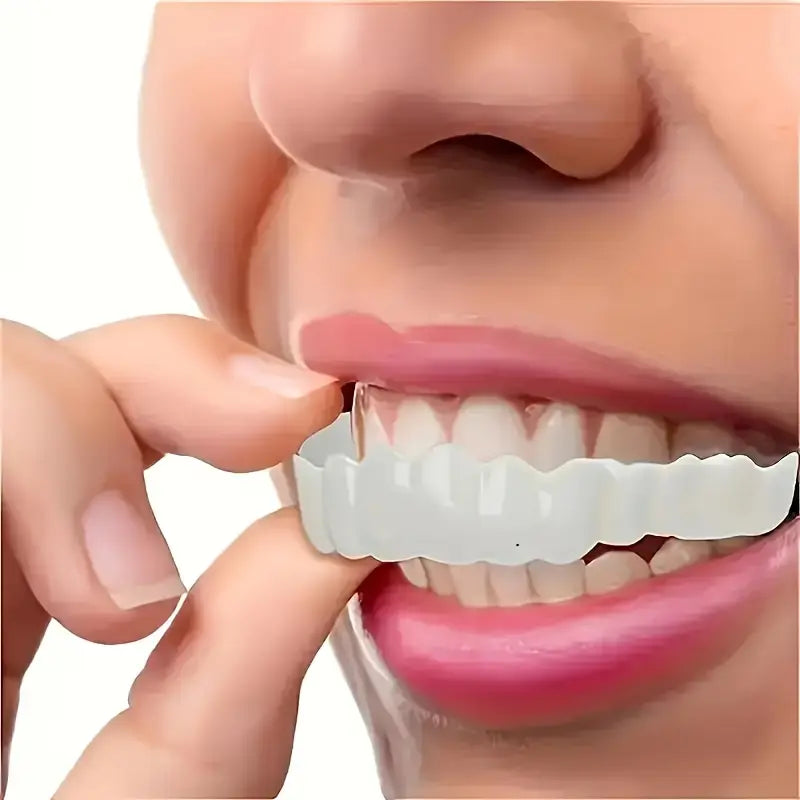 Realistic Dental Veeners - Upper & Lower Teeth, Natural Look & Whitening