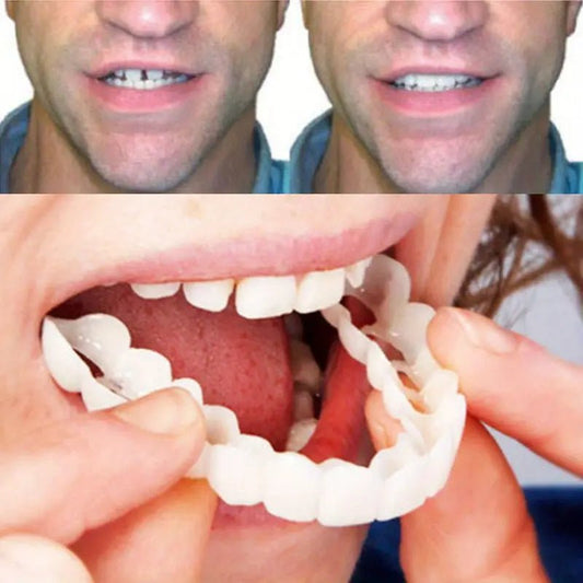 Realistic Dental Veeners - Upper & Lower Teeth, Natural Look & Whitening - Trendsters Pk