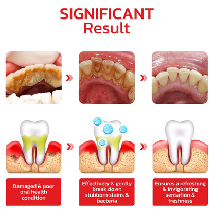 𝗢𝗿𝗶𝗴𝗻𝗮𝗹™ 𝗦𝗣𝟰 𝗨𝗹𝘁𝗿𝗮 𝗧𝗲𝗲𝘁𝗵 𝗪𝗵𝗶𝘁𝗲𝗻𝗶𝗻𝗴 𝗧𝗼𝗼𝘁𝗽𝗮𝘀𝘁𝗲