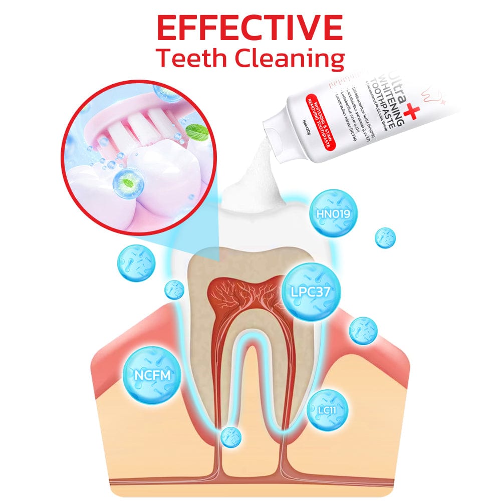 𝗢𝗿𝗶𝗴𝗻𝗮𝗹™ 𝗦𝗣𝟰 𝗨𝗹𝘁𝗿𝗮 𝗧𝗲𝗲𝘁𝗵 𝗪𝗵𝗶𝘁𝗲𝗻𝗶𝗻𝗴 𝗧𝗼𝗼𝘁𝗽𝗮𝘀𝘁𝗲