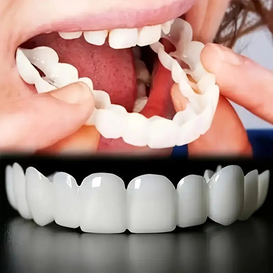 Realistic Dental Veeners - Upper & Lower Teeth, Natural Look & Whitening