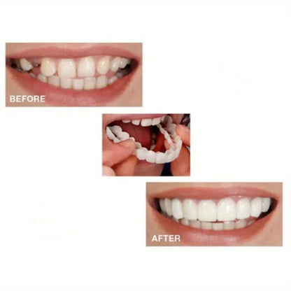 Realistic Dental Veeners - Upper & Lower Teeth, Natural Look & Whitening