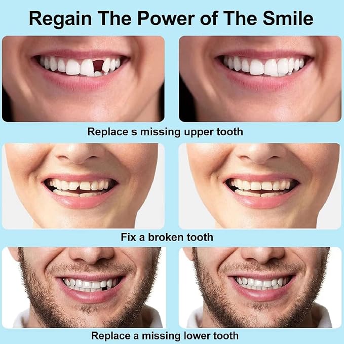 Orignal™ Moldable False Teeth