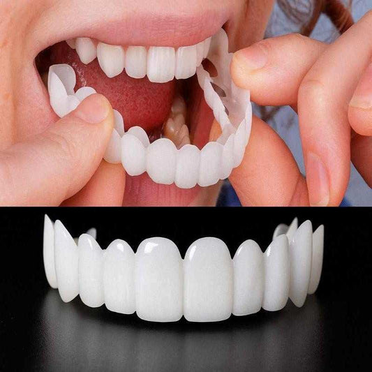 Realistic Dental Veeners - Upper & Lower Teeth, Natural Look & Whitening